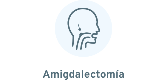 Amigdalectomía