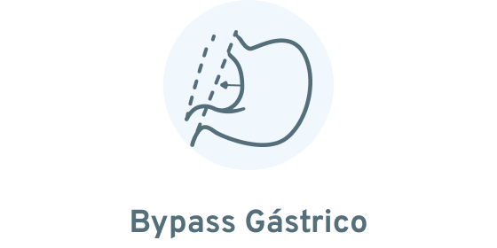Bypass Gástrico