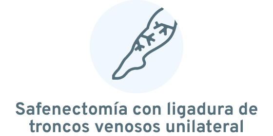 Safenectomía con ligadura de troncos venosos unilateral