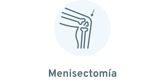 Menisectomía por vía artroscopica