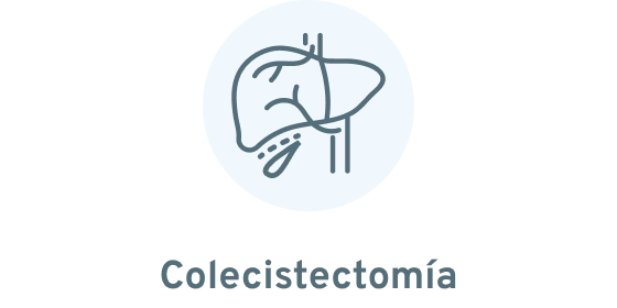 Colecistectomía laparoscópica adulto