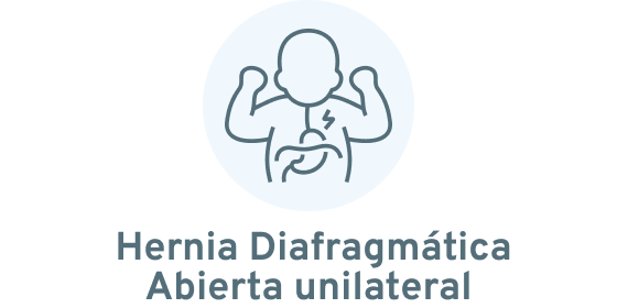 Hernia Diafragmática Abierta Unilateral 