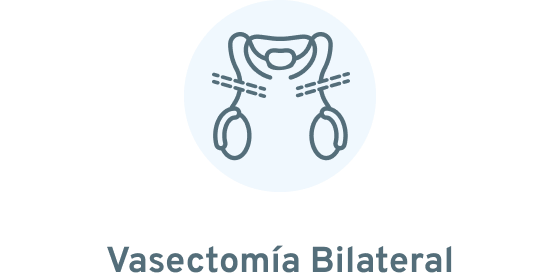 Vasectomía bilateral 