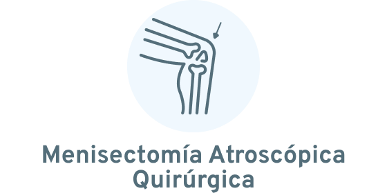 Menisectomía por vía artroscopica